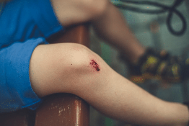  An individual with a minor injury after a car accident