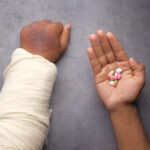 Nanda & Associate Lawyers Canada - Man with a broken arm