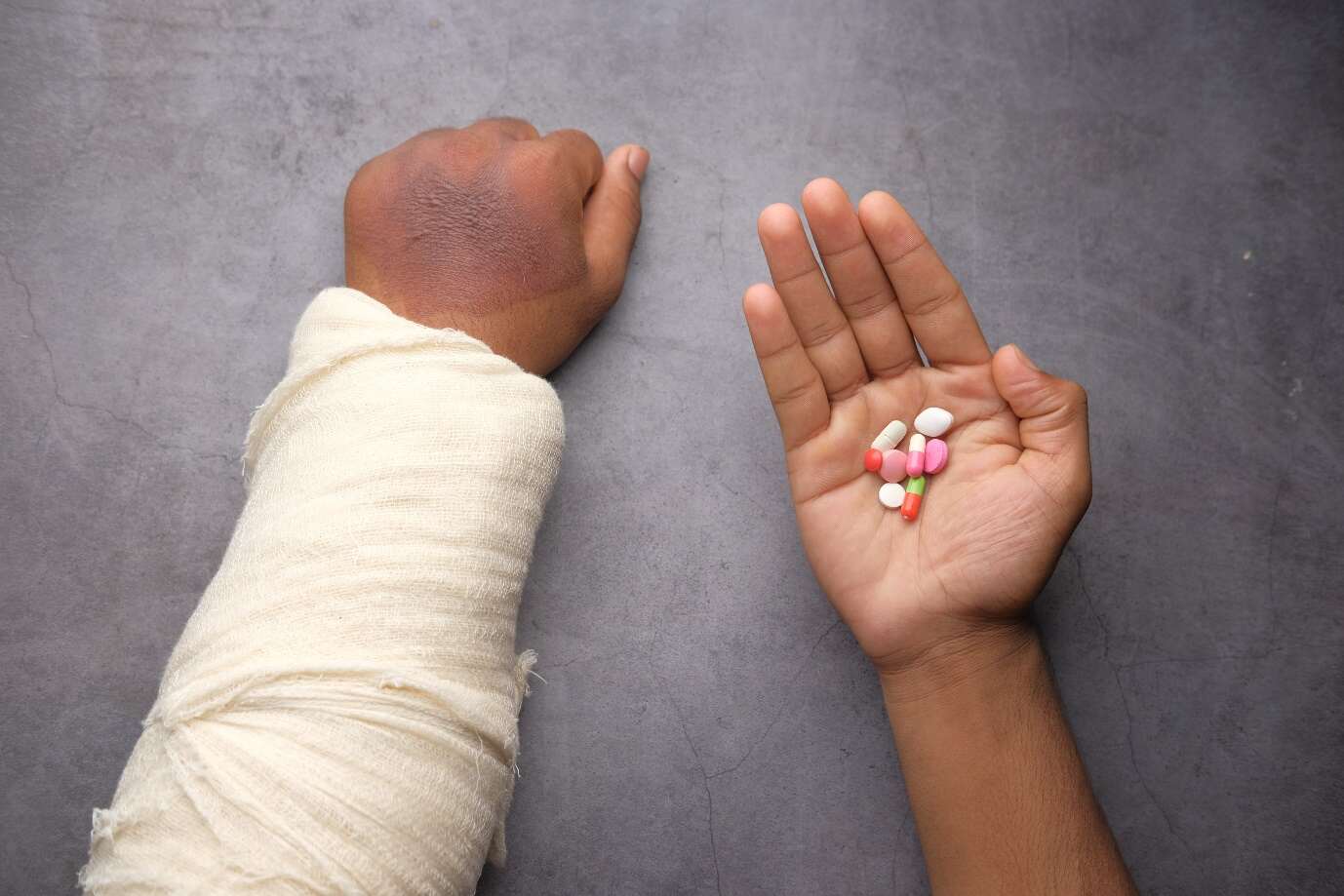 Nanda & Associate Lawyers Canada - Man with a broken arm